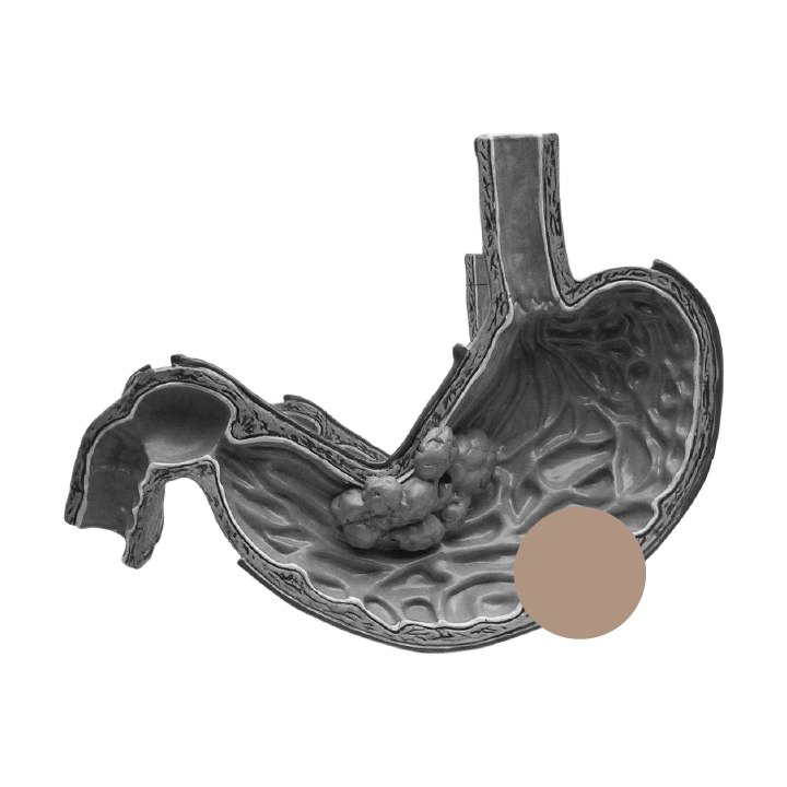a gray and black image of a stomach