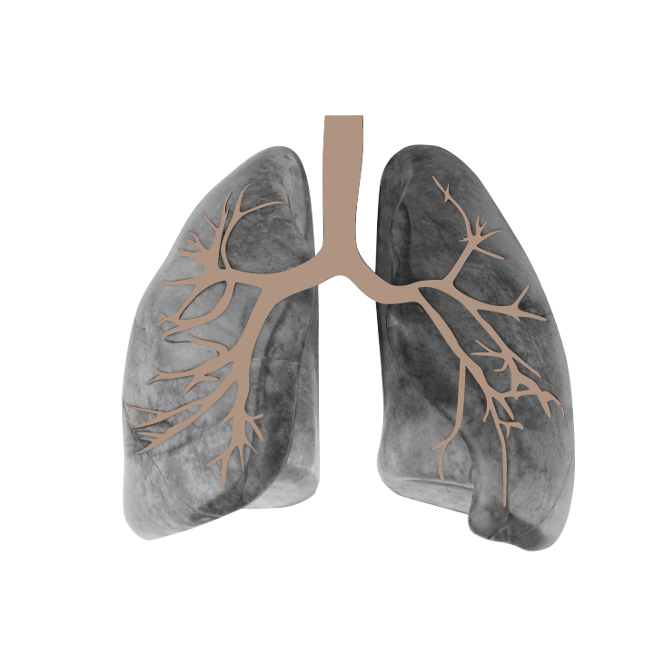 gray and brown image of lungs