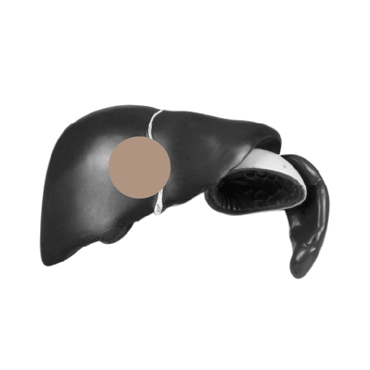 Black and gray image of a liver