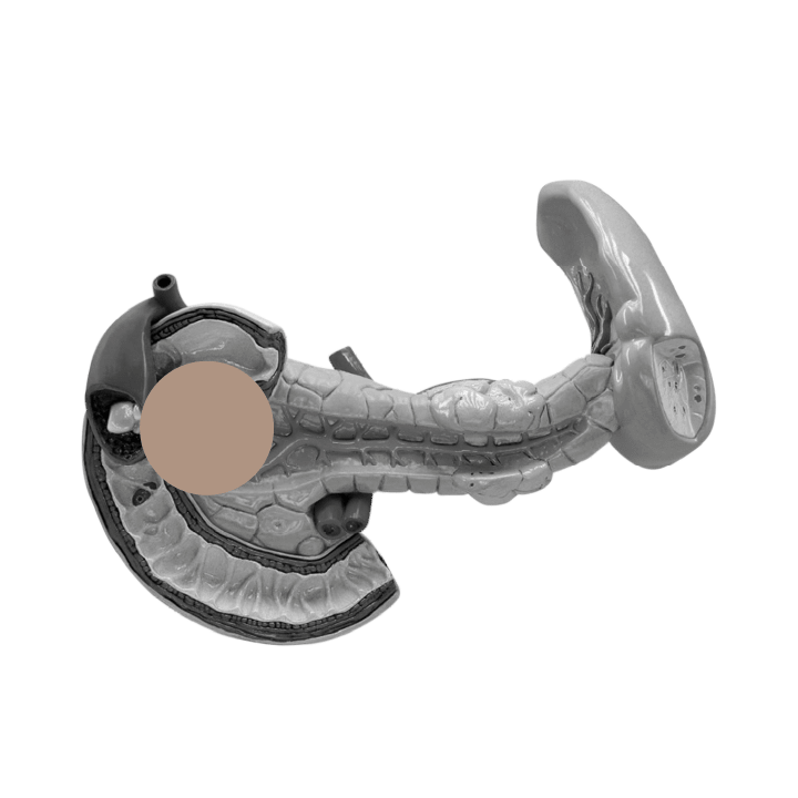 Gray, black, and brown image of a pancreas